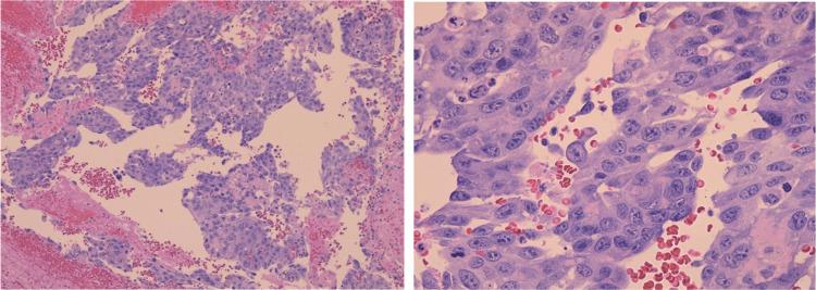 https://cdn.ncbi.nlm.nih.gov/pmc/blobs/ced6/11315593/6b45b5d96204/cureus-0016-00000064273-i04.jpg