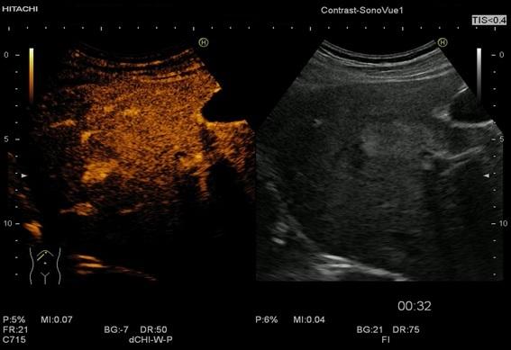 https://cdn.ncbi.nlm.nih.gov/pmc/blobs/ced6/7716767/3d2ad4e4d067/CHSJ-46-03-255-fig5.jpg