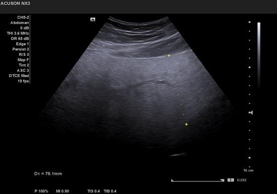https://cdn.ncbi.nlm.nih.gov/pmc/blobs/ced6/7716767/de9e8dbbaf2c/CHSJ-46-03-255-fig2.jpg
