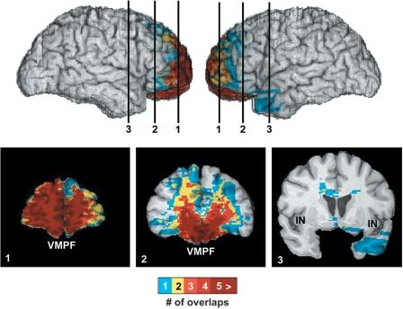 https://cdn.ncbi.nlm.nih.gov/pmc/blobs/ced8/2638229/7d8eb694b98f/awn066f1.jpg