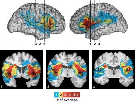 https://cdn.ncbi.nlm.nih.gov/pmc/blobs/ced8/2638229/d142de39a7d7/awn066f2.jpg