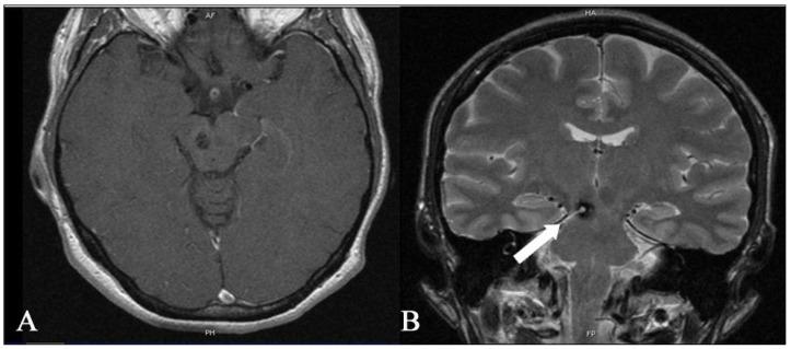 https://cdn.ncbi.nlm.nih.gov/pmc/blobs/cedb/10537097/d2745a7c4fd8/medicina-59-01601-g006.jpg
