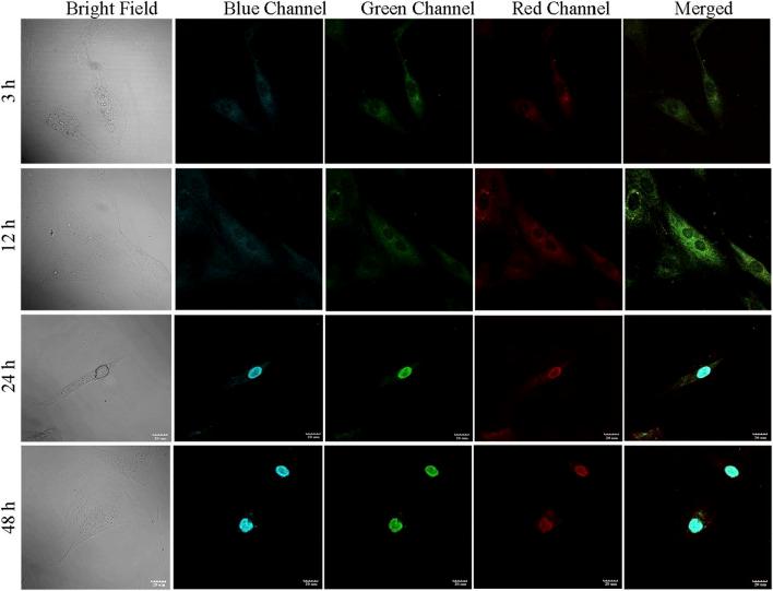 https://cdn.ncbi.nlm.nih.gov/pmc/blobs/cedc/10493328/7cc22cdada98/fbioe-11-1213932-g005.jpg