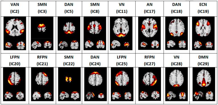 https://cdn.ncbi.nlm.nih.gov/pmc/blobs/cee2/9405767/743446577568/brainsci-12-01049-g001.jpg