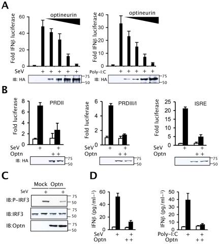 https://cdn.ncbi.nlm.nih.gov/pmc/blobs/cee4/2824764/5e66f51556e5/ppat.1000778.g002.jpg