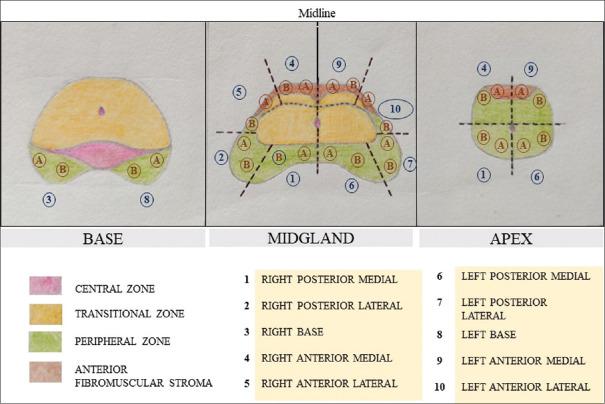 https://cdn.ncbi.nlm.nih.gov/pmc/blobs/cee6/11567580/4ef792a7edab/IJU-40-229-g002.jpg