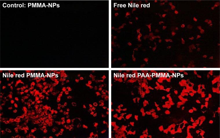 https://cdn.ncbi.nlm.nih.gov/pmc/blobs/ceed/5863624/dff821649c42/ijn-13-101Fig3.jpg