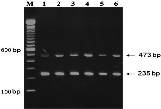 https://cdn.ncbi.nlm.nih.gov/pmc/blobs/cef6/3401710/27a415ab5030/IJMR-135-756-g001.jpg