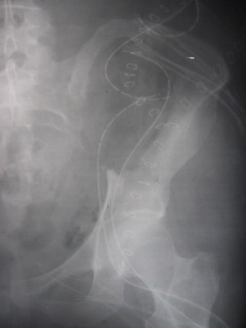 https://cdn.ncbi.nlm.nih.gov/pmc/blobs/cef7/538289/420c180fa51a/1477-7819-2-38-3.jpg