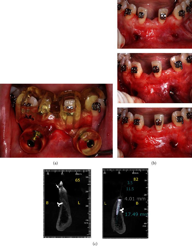 https://cdn.ncbi.nlm.nih.gov/pmc/blobs/cef8/11502131/13acca60d4a2/CRID2024-5901688.009.jpg