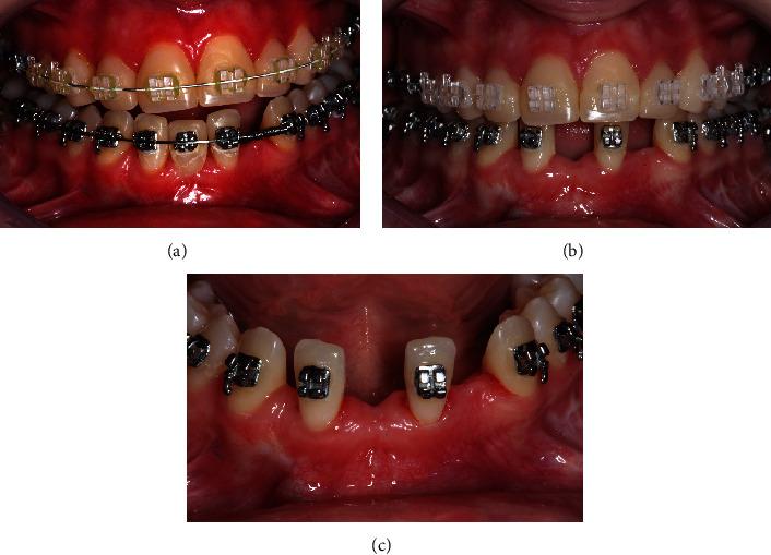 https://cdn.ncbi.nlm.nih.gov/pmc/blobs/cef8/11502131/22a0f2419ef1/CRID2024-5901688.008.jpg