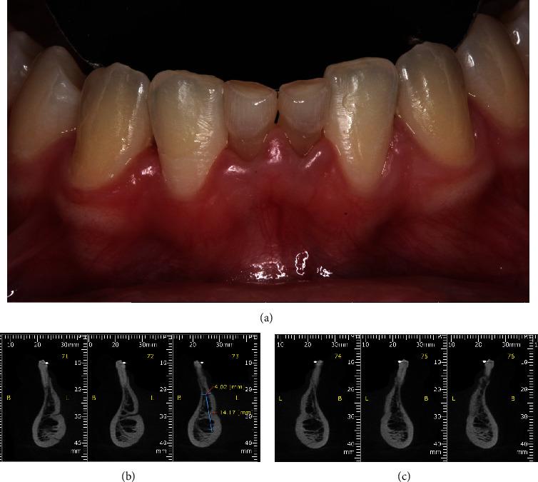 https://cdn.ncbi.nlm.nih.gov/pmc/blobs/cef8/11502131/54d087017d3c/CRID2024-5901688.003.jpg