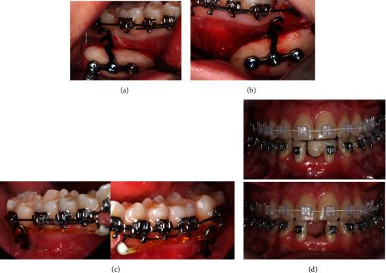https://cdn.ncbi.nlm.nih.gov/pmc/blobs/cef8/11502131/87292d990c13/CRID2024-5901688.007.jpg