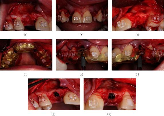 https://cdn.ncbi.nlm.nih.gov/pmc/blobs/cef8/11502131/be3fd2282c52/CRID2024-5901688.011.jpg
