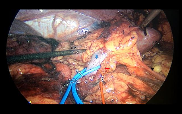 https://cdn.ncbi.nlm.nih.gov/pmc/blobs/cf03/7532696/b890105ec0f7/anntransplant-25-e926422-g001.jpg
