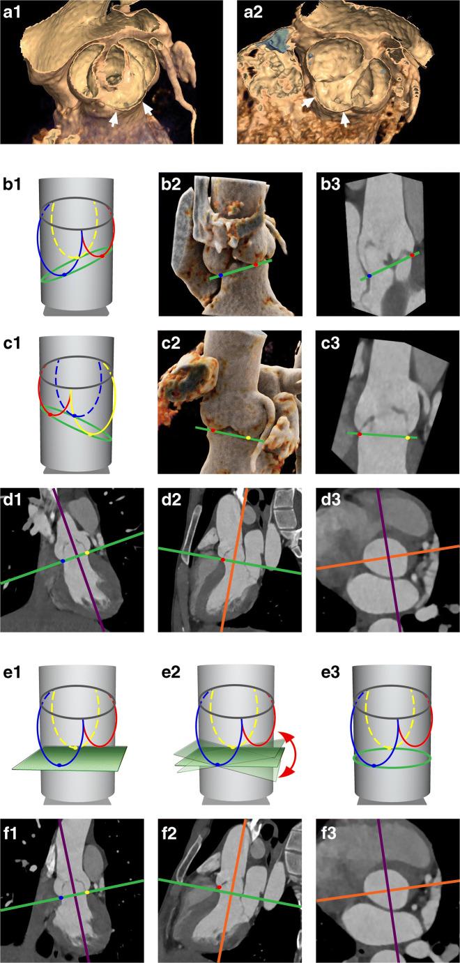 https://cdn.ncbi.nlm.nih.gov/pmc/blobs/cf11/8523432/5e7aaa3661b1/330_2021_7916_Fig1_HTML.jpg
