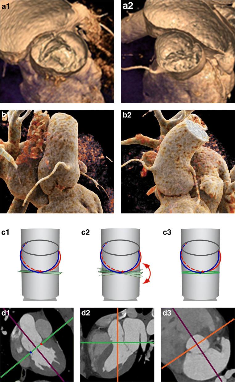 https://cdn.ncbi.nlm.nih.gov/pmc/blobs/cf11/8523432/67dc046ce2e7/330_2021_7916_Fig2_HTML.jpg