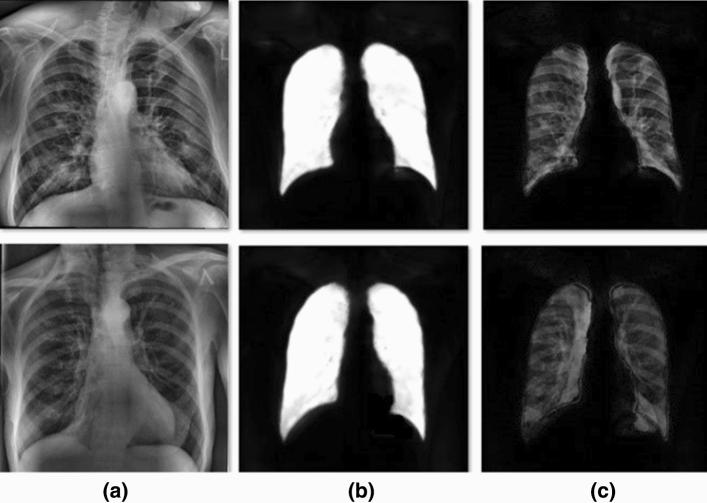 https://cdn.ncbi.nlm.nih.gov/pmc/blobs/cf15/9016694/23bb3dc99a96/521_2022_7258_Fig9_HTML.jpg