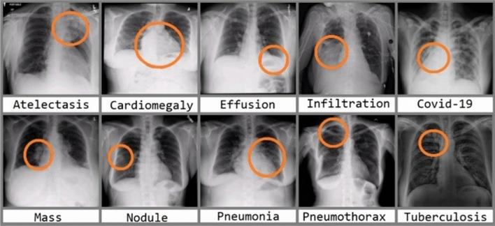 https://cdn.ncbi.nlm.nih.gov/pmc/blobs/cf15/9016694/7e39601f7515/521_2022_7258_Fig2_HTML.jpg