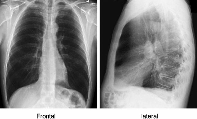 https://cdn.ncbi.nlm.nih.gov/pmc/blobs/cf15/9016694/84eba20803fe/521_2022_7258_Fig1_HTML.jpg