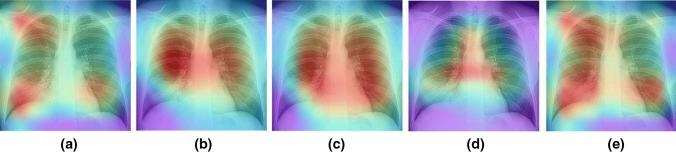 https://cdn.ncbi.nlm.nih.gov/pmc/blobs/cf15/9016694/88616788fd4a/521_2022_7258_Fig17_HTML.jpg