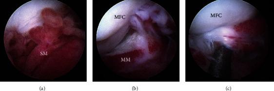 https://cdn.ncbi.nlm.nih.gov/pmc/blobs/cf17/10113050/32c5be8d8daf/CRIVEM2023-6811238.003.jpg