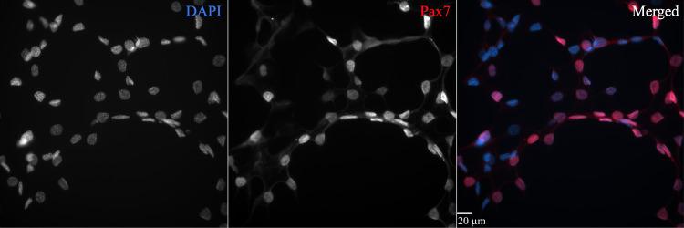 https://cdn.ncbi.nlm.nih.gov/pmc/blobs/cf18/12021681/706143f5222d/BioProtoc-15-8-5281-g004.jpg