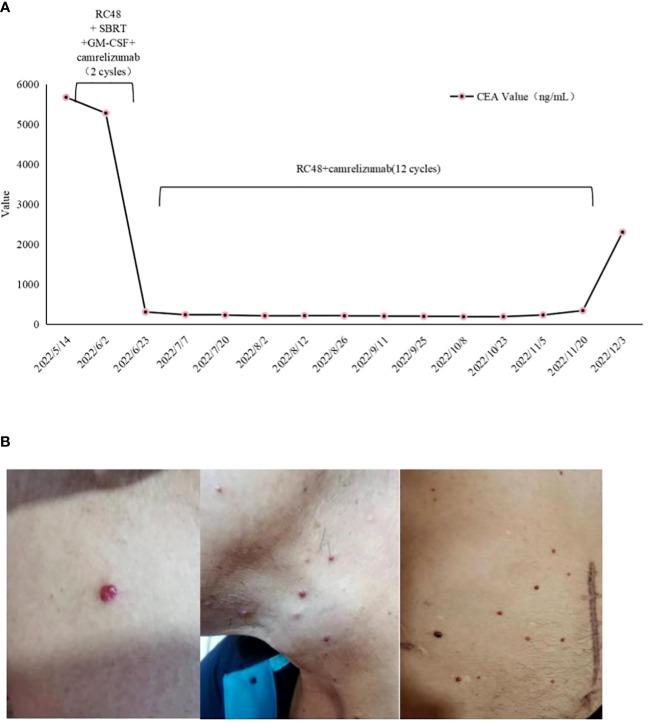 https://cdn.ncbi.nlm.nih.gov/pmc/blobs/cf20/10867122/53bf081dc526/fimmu-15-1321946-g004.jpg