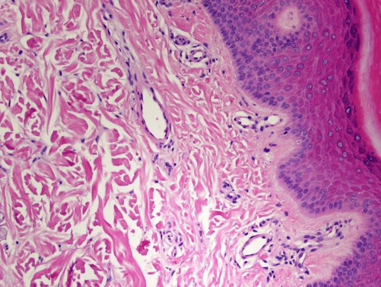 https://cdn.ncbi.nlm.nih.gov/pmc/blobs/cf22/10990651/2ec8b50850fc/cureus-0016-00000055509-i03.jpg