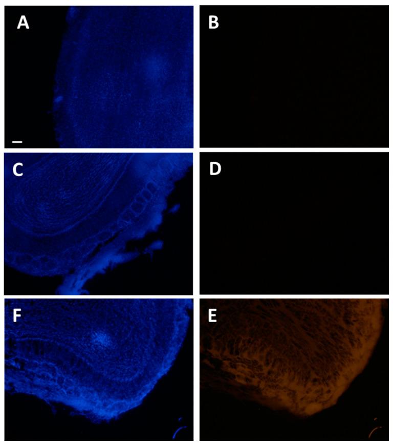 https://cdn.ncbi.nlm.nih.gov/pmc/blobs/cf25/10253593/69fc2247a4c8/ijms-24-09648-g004.jpg