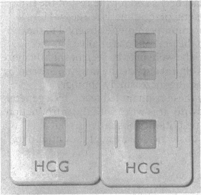 https://cdn.ncbi.nlm.nih.gov/pmc/blobs/cf35/1675435/e269421e6a72/bmj00117-0054-a.jpg