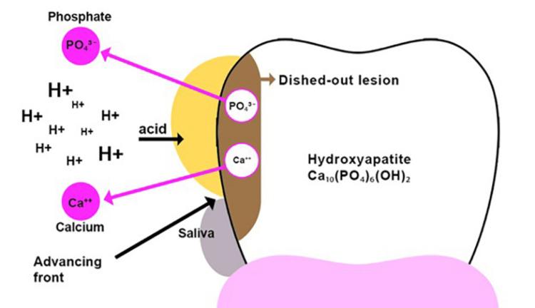 https://cdn.ncbi.nlm.nih.gov/pmc/blobs/cf3b/12182706/cea5574eac09/cureus-0017-00000084668-i02.jpg