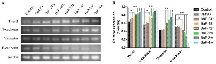 https://cdn.ncbi.nlm.nih.gov/pmc/blobs/cf3d/5652958/bd999e66a7d6/OR-38-04-2141-g02.jpg