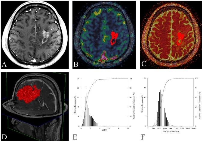 https://cdn.ncbi.nlm.nih.gov/pmc/blobs/cf3e/4242641/d2da02bd41a7/pone.0113587.g006.jpg