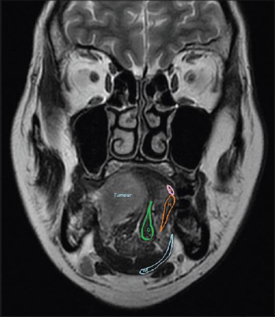 https://cdn.ncbi.nlm.nih.gov/pmc/blobs/cf49/7546288/0a07dcc5ef84/IJRI-30-126-g011.jpg