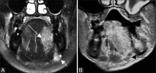 https://cdn.ncbi.nlm.nih.gov/pmc/blobs/cf49/7546288/31150e74895c/IJRI-30-126-g016.jpg