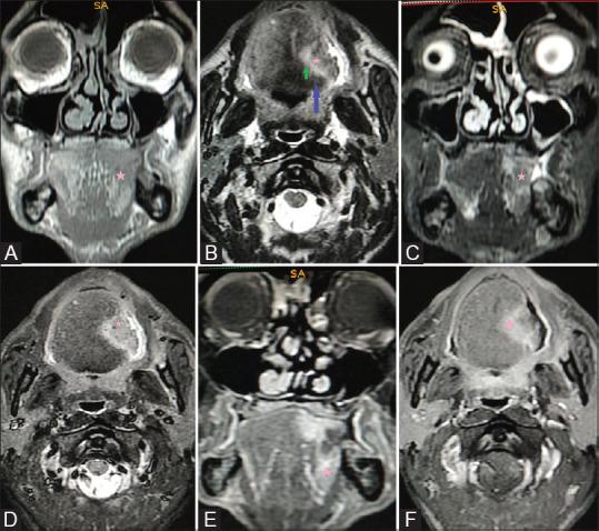 https://cdn.ncbi.nlm.nih.gov/pmc/blobs/cf49/7546288/86b4d41fad99/IJRI-30-126-g006.jpg