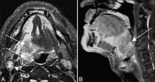 https://cdn.ncbi.nlm.nih.gov/pmc/blobs/cf49/7546288/906af33bdebb/IJRI-30-126-g013.jpg
