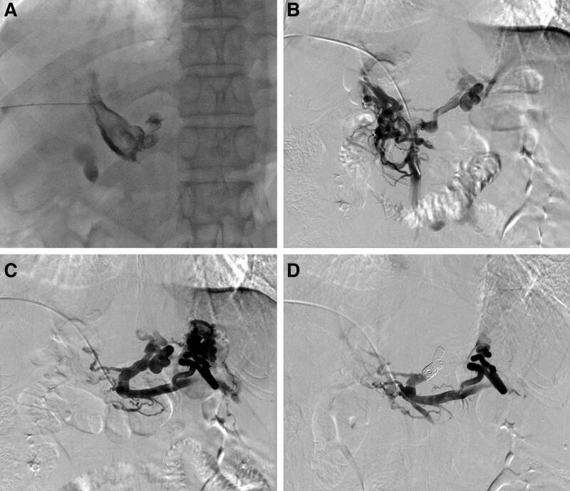 https://cdn.ncbi.nlm.nih.gov/pmc/blobs/cf4d/10118327/ff908990d17a/medi-102-e33608-g002.jpg