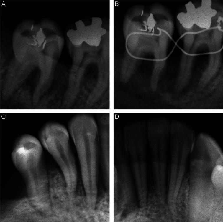https://cdn.ncbi.nlm.nih.gov/pmc/blobs/cf4d/10990345/deecb1e6ca59/ms9-86-2266-g003.jpg
