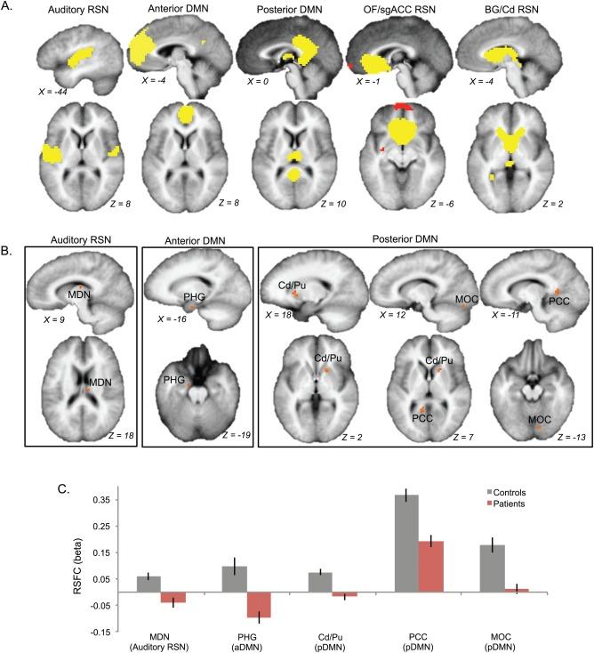 https://cdn.ncbi.nlm.nih.gov/pmc/blobs/cf4f/6867316/8346663cd499/HBM-37-2717-g001.jpg