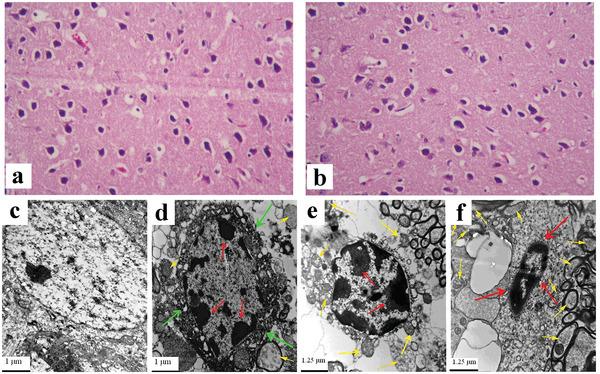 https://cdn.ncbi.nlm.nih.gov/pmc/blobs/cf4f/9165481/1bd6b66e73b8/ADVS-9-2106049-g007.jpg