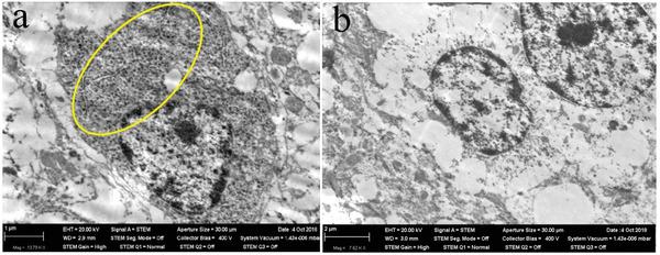 https://cdn.ncbi.nlm.nih.gov/pmc/blobs/cf4f/9165481/3c0b34ed577f/ADVS-9-2106049-g009.jpg