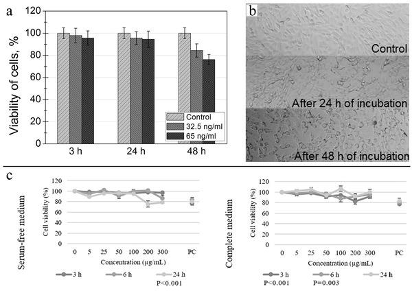 https://cdn.ncbi.nlm.nih.gov/pmc/blobs/cf4f/9165481/4075405898ed/ADVS-9-2106049-g006.jpg