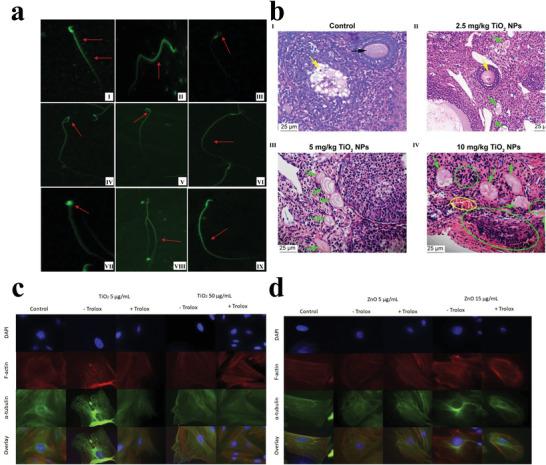 https://cdn.ncbi.nlm.nih.gov/pmc/blobs/cf4f/9165481/74e94b7b4bd6/ADVS-9-2106049-g010.jpg