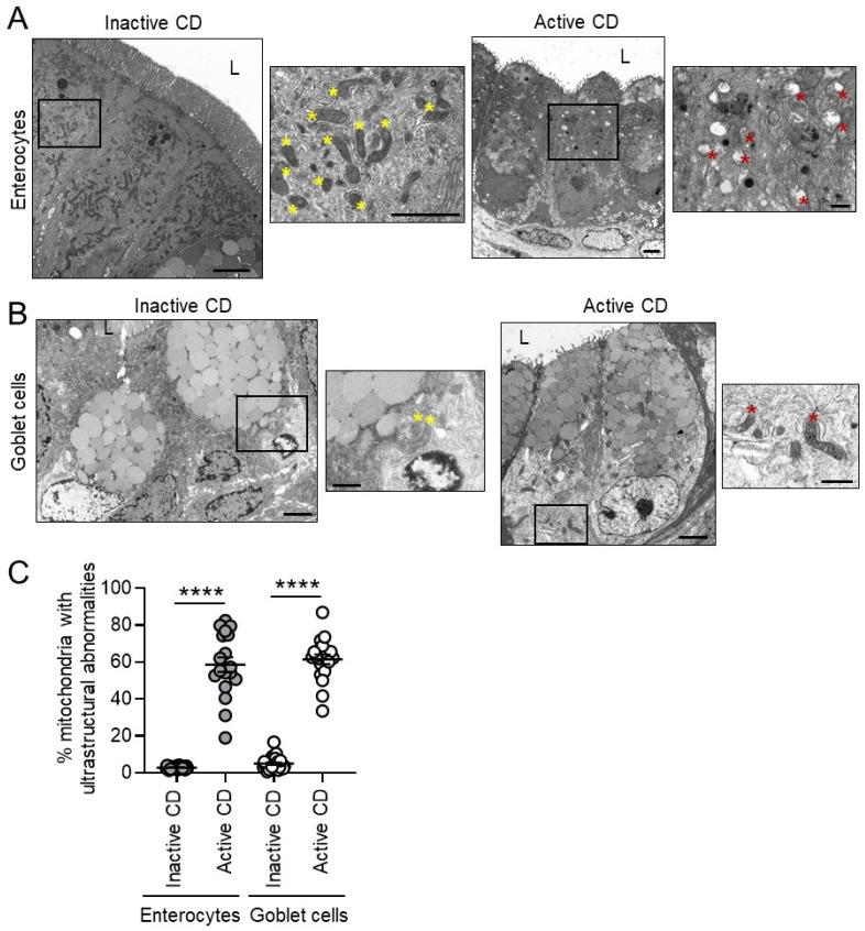 https://cdn.ncbi.nlm.nih.gov/pmc/blobs/cf54/8226558/6dedc2e49dbc/cells-10-01349-g003.jpg
