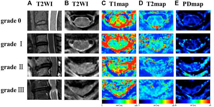 https://cdn.ncbi.nlm.nih.gov/pmc/blobs/cf55/10123267/a9625c3b8cb8/fphys-14-1140870-g001.jpg