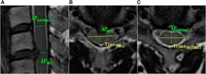 https://cdn.ncbi.nlm.nih.gov/pmc/blobs/cf55/10123267/e11f6577bae7/fphys-14-1140870-g002.jpg