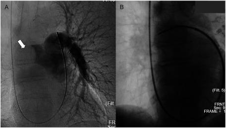 https://cdn.ncbi.nlm.nih.gov/pmc/blobs/cf59/6600104/a662f3bab48d/avd-12-2-hdi.19-00001-figure02.jpg