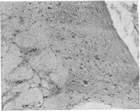 https://cdn.ncbi.nlm.nih.gov/pmc/blobs/cf5e/1926148/a505d985358c/brmedj02989-0026-f.jpg